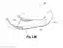 Fig. 43 - Spinal implant system and method