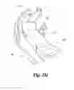 Fig. 44 - Spinal implant system and method