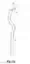 Fig. 45 - Spinal implant system and method