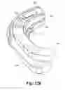 Fig. 47 - Spinal implant system and method