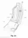 Fig. 48 - Spinal implant system and method