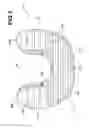 Fig. 03 - Interbody spacer