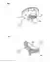 Fig. 08 - Method of shoulder arthroplasty with adjustable angle of inclination