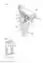 Fig. 09 - Method of shoulder arthroplasty with adjustable angle of inclination
