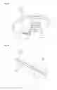 Fig. 11 - Method of shoulder arthroplasty with adjustable angle of inclination