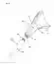 Fig. 13 - Method of shoulder arthroplasty with adjustable angle of inclination