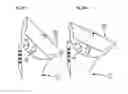 Fig. 17 - Method of shoulder arthroplasty with adjustable angle of inclination