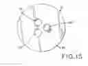 Fig. 08 - Prosthetic patella