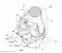 Fig. 01 - KNEE PROSTHESIS
