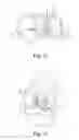Fig. 08 - KNEE PROSTHESIS