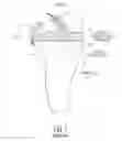 Fig. 02 - Bicruciate retaining tibial baseplate design and method of implantation
