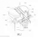 Fig. 08 - Bicruciate retaining tibial baseplate design and method of implantation