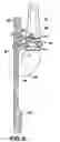 Fig. 04 - Trapezium implant for thumb and method