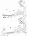 Fig. 06 - BIFURCATED, MULTI-PURPOSE PROSTHETIC FOOT