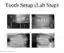 Fig. 01 - SYSTEMS FOR DENTURE PREPARATION