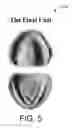 Fig. 06 - SYSTEMS FOR DENTURE PREPARATION