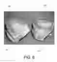 Fig. 07 - SYSTEMS FOR DENTURE PREPARATION