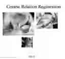 Fig. 10 - SYSTEMS FOR DENTURE PREPARATION