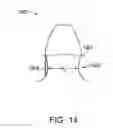 Fig. 15 - SYSTEMS FOR DENTURE PREPARATION
