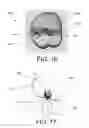 Fig. 17 - SYSTEMS FOR DENTURE PREPARATION