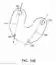 Fig. 19 - SYSTEMS FOR DENTURE PREPARATION