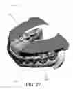 Fig. 25 - SYSTEMS FOR DENTURE PREPARATION