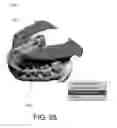 Fig. 26 - SYSTEMS FOR DENTURE PREPARATION