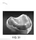Fig. 28 - SYSTEMS FOR DENTURE PREPARATION