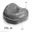 Fig. 33 - SYSTEMS FOR DENTURE PREPARATION
