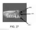 Fig. 34 - SYSTEMS FOR DENTURE PREPARATION