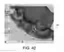 Fig. 37 - SYSTEMS FOR DENTURE PREPARATION