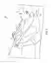 Fig. 03 - Integrated patient pull up system