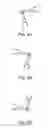 Fig. 09 - Motion analysis device and motion analysis method for analyzing deformation of measurement object