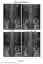 Fig. 13 - E-medstick, e-medstick, e-medstick EMR