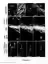 Fig. 03 - Tool for studying endothelial haematopoietic transition (EHT) and epithelial-mesenchymal transition (EMT) associated events