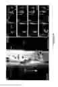 Fig. 07 - Tool for studying endothelial haematopoietic transition (EHT) and epithelial-mesenchymal transition (EMT) associated events