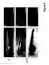 Fig. 13 - MicroRNA-24