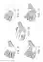 Fig. 05 - Glove with strengthening inserts