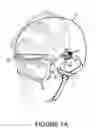 Fig. 02 - Goggle attachment system for a helmet