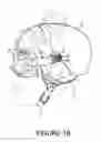 Fig. 03 - Goggle attachment system for a helmet