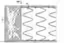 Fig. 01 - MATTRESS CONSTRUCTIONS WITH DENSIFIED FIBER COMPONENTS