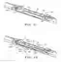 Fig. 09 - Windshield wiper blade assembly