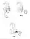 Fig. 02 - Self-locking clip systems and methods