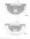 Fig. 09 - Method for manufacturing a prosthetic hip acetabulum