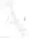 Fig. 04 - Recoil absorbing stock
