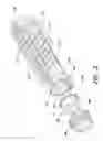 Fig. 04 - Modular fore-end rail/hand guard assembly system for firearms with selectable heat dissipation characteristics