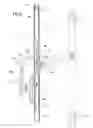 Fig. 06 - Casement window unit with an operating and closing slide unit for the movable frame of the window unit