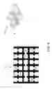Fig. 07 - Safety surfacing tile support