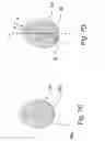 Fig. 10 - Container for eggs, method and apparatus for arranging and stabilizing eggs in a container