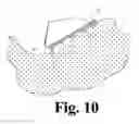Fig. 08 - Hoof Boot